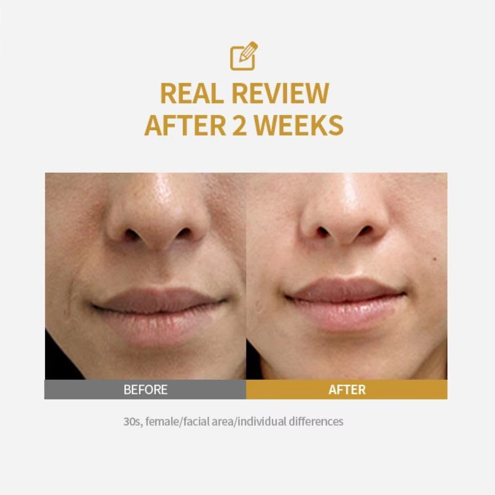 Ampolla Intensiva al Peptide p - Collagen Peptide Powder recensione e prezzo